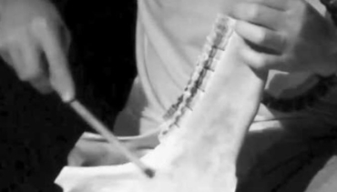 Denti e musica
