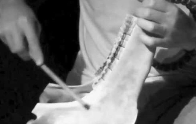 Denti e musica