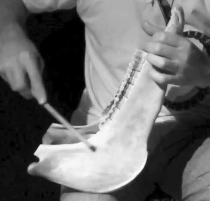 Denti e musica
