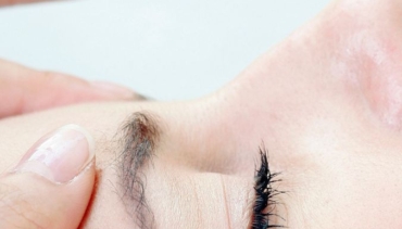 Biostimolazione