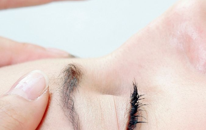 Biostimolazione