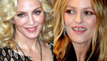 Il diastema