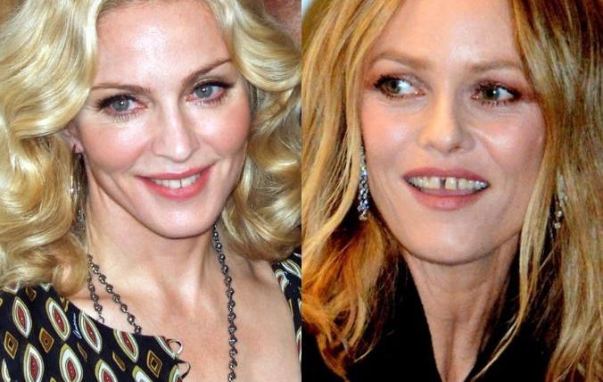 Il diastema