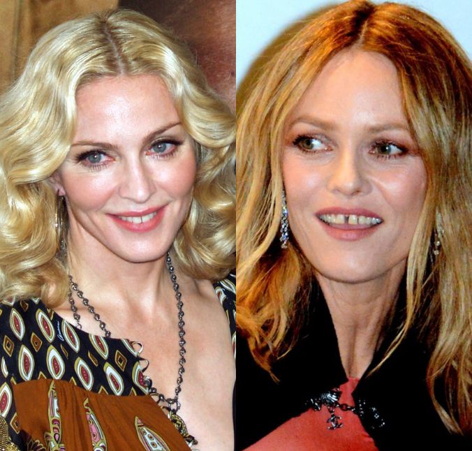 Il diastema